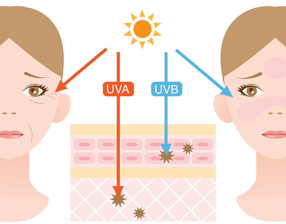 Tác hại của tia UVA và UVB đối với làn da